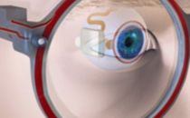 将智能设备植入眼球 却能够有效缓解干眼症