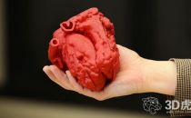Materialise总裁呼吁关注3D打印医疗事业