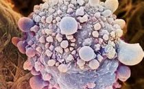 Nature新研究：会传染的癌细胞？
